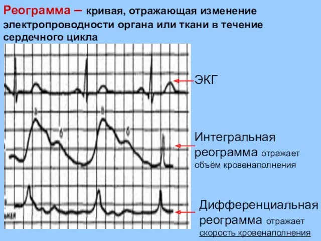 Реограмма – кривая, отражающая изменение электропроводности органа или ткани в