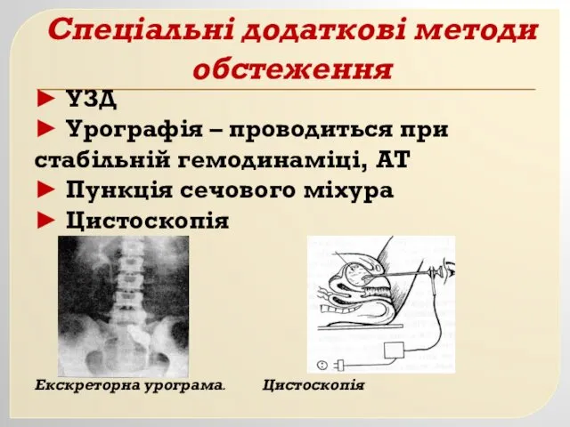 Спеціальні додаткові методи обстеження ► УЗД ► Урографія – проводиться