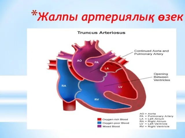 Жалпы артериялық өзек