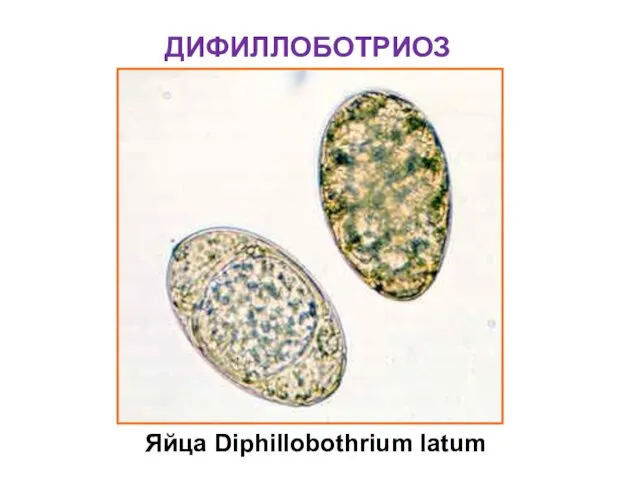 ДИФИЛЛОБОТРИОЗ Яйца Diphillobothrium latum