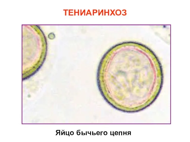 ТЕНИАРИНХОЗ Яйцо бычьего цепня