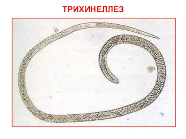 ТРИХИНЕЛЛЕЗ Trichinella spiralis, взрослая самка