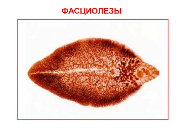 ФАСЦИОЛЕЗЫ Взрослая форма Fasciola hepatica