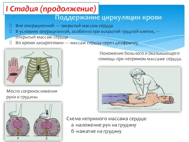 Поддержание циркуляции крови Вне операционной — закрытый массаж сердца В