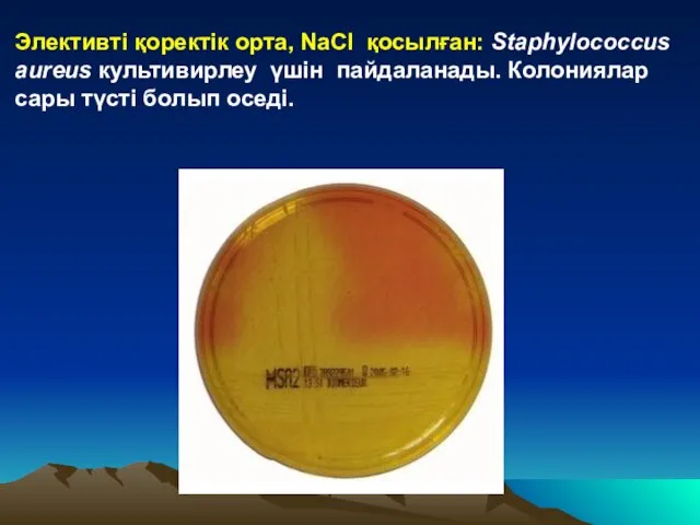 Элективті қоректік орта, NaCl қосылған: Staphylococcus aureus культивирлеу үшін пайдаланады. Колониялар сары түсті болып оседі.
