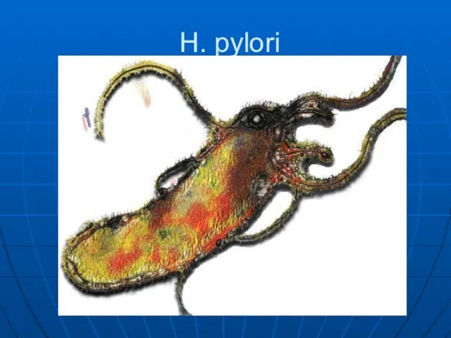 H. pylori