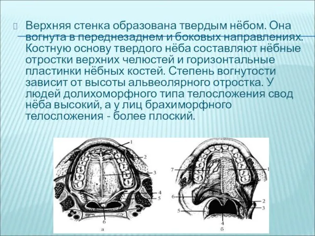 Верхняя стенка образована твердым нёбом. Она вогнута в переднезаднем и