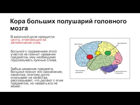 Кора больших полушарий головного мозга В височной доле находится центр,