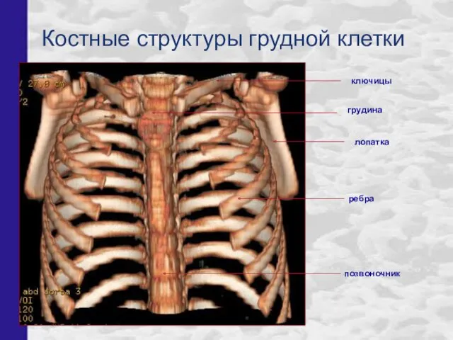 Костные структуры грудной клетки ключицы грудина ребра позвоночник лопатка