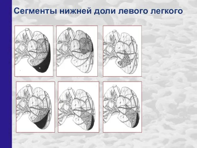 Сегменты нижней доли левого легкого