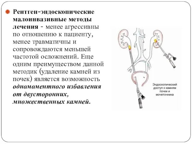 Рентген-эндоскопические малоинвазивные методы лечения - менее агрессивны по отношению к