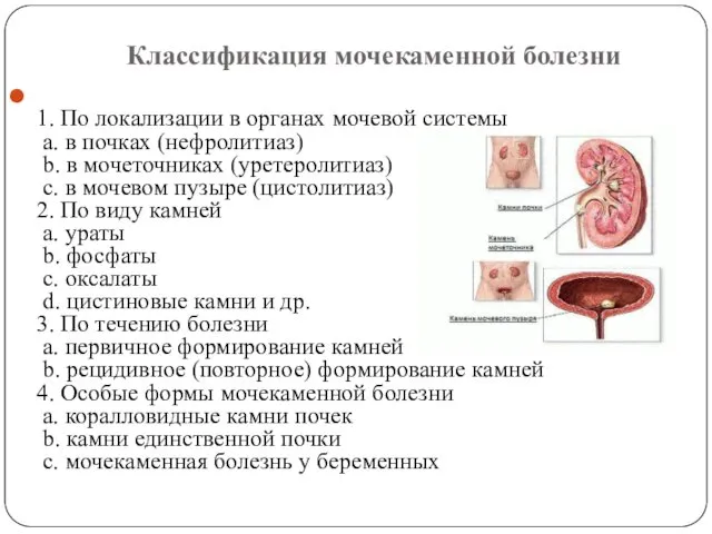 Классификация мочекаменной болезни 1. По локализации в органах мочевой системы