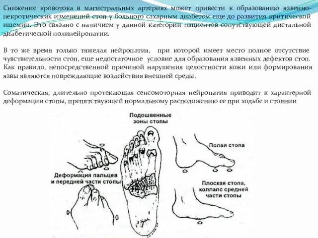 Снижение кровотока в магистральных артериях может привести к образованию язвенно-некротических