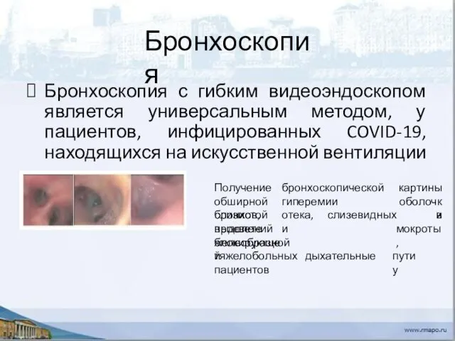 Бронхоскопия Бронхоскопия с гибким видеоэндоскопом является универсальным методом, у пациентов, инфицированных COVID-19, находящихся