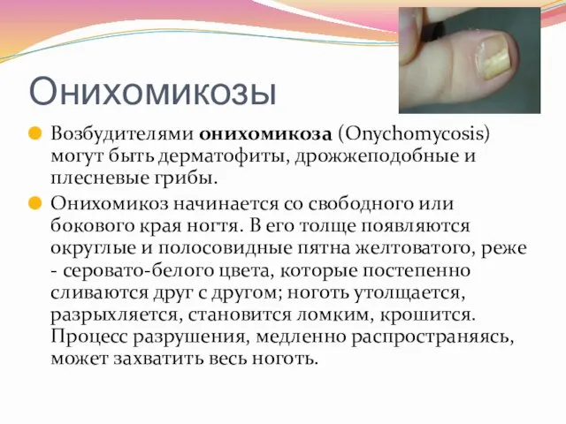 Онихомикозы Возбудителями онихомикоза (Onychomycosis) могут быть дерматофиты, дрожжеподобные и плесневые