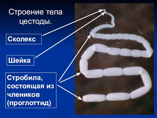 Строение тела цестоды. Сколекс Шейка Стробила, состоящая из члеников (проглоттид)