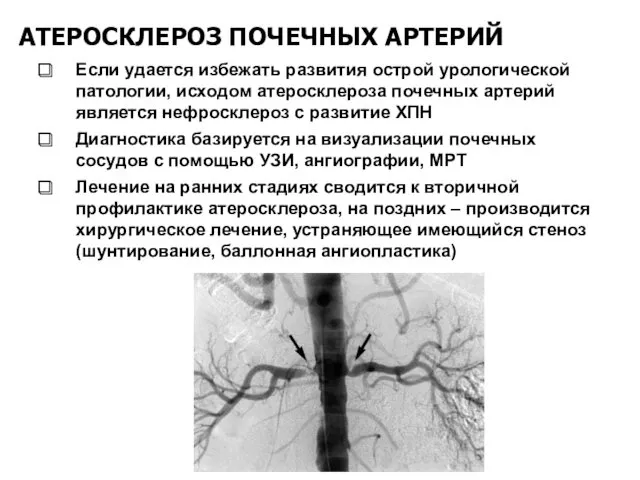 АТЕРОСКЛЕРОЗ ПОЧЕЧНЫХ АРТЕРИЙ Если удается избежать развития острой урологической патологии,