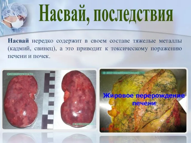 Насвай, последствия Насвай нередко содержит в своем составе тяжелые металлы