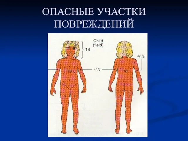 ОПАСНЫЕ УЧАСТКИ ПОВРЕЖДЕНИЙ