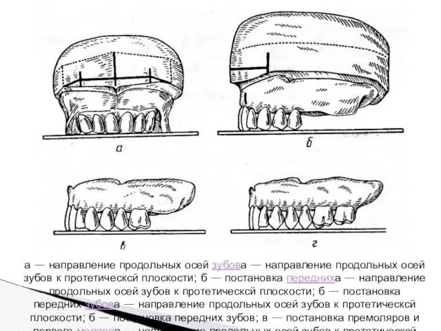 а — направление продольных осей зубова — направление продольных осей