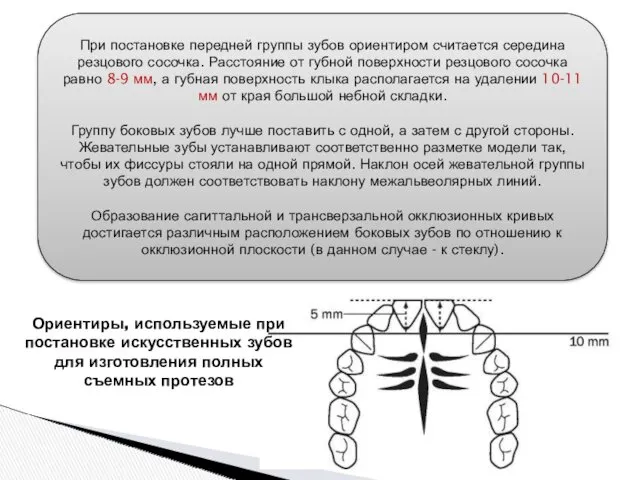 При постановке передней группы зубов ориентиром считается середина резцового сосочка.