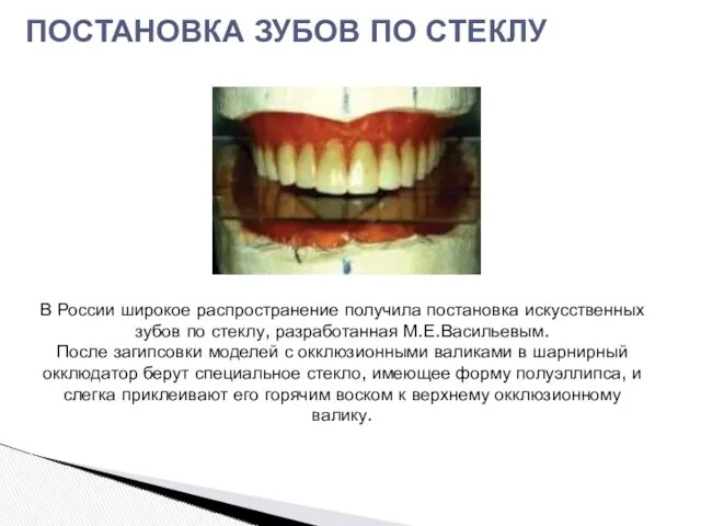 ПОСТАНОВКА ЗУБОВ ПО СТЕКЛУ В России широкое распространение получила постановка