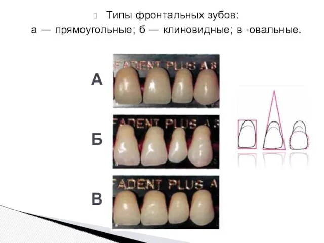 Типы фронтальных зубов: а — прямоугольные; б — клиновидные; в -овальные. А Б В