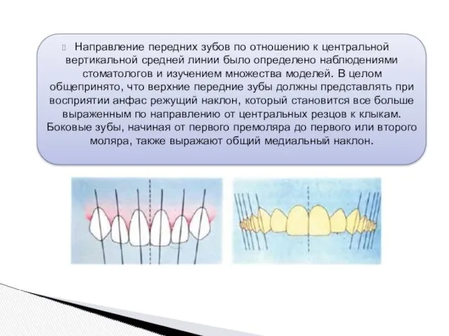 Направление передних зубов по отношению к центральной вертикальной средней линии