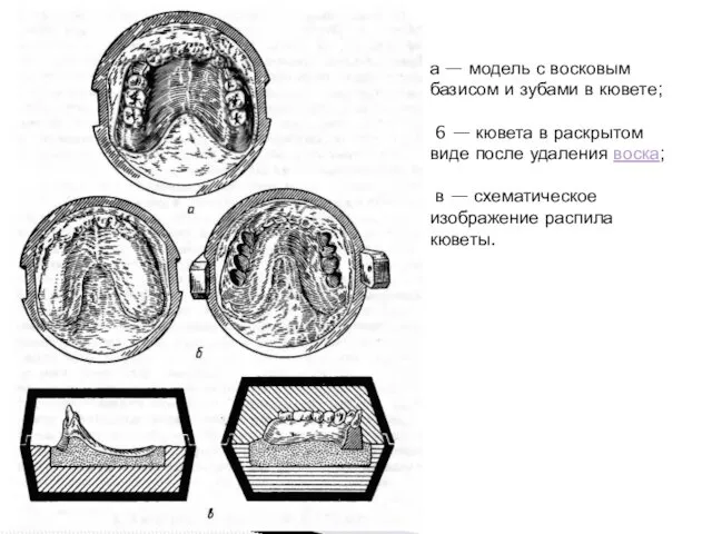 а — модель с восковым базисом и зубами в кювете;