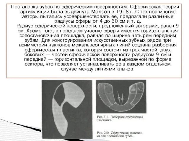 Постановка зубов по сферическим поверхностям. Сферическая теория артикуляции была выдвинута