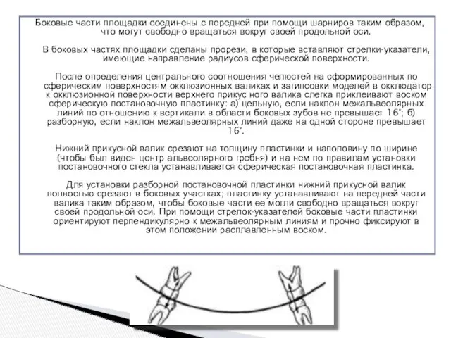 Боковые части площадки соединены с передней при помощи шарниров таким