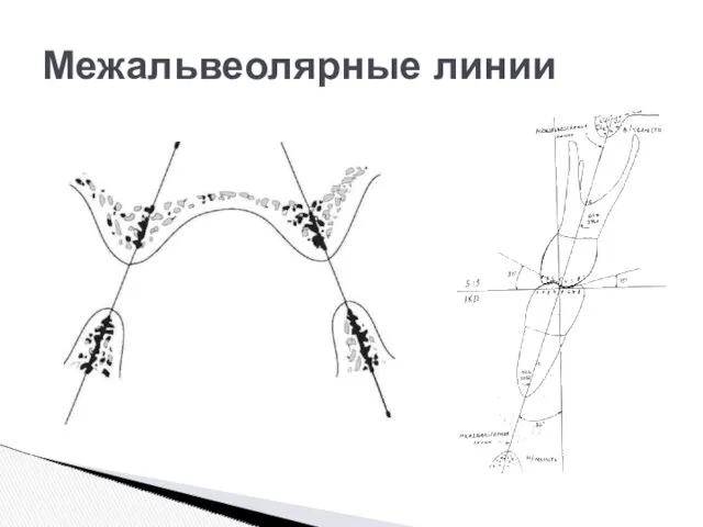 Межальвеолярные линии