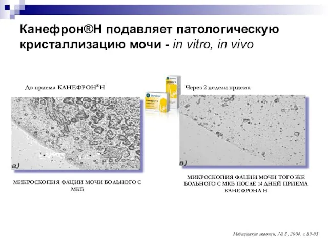 Канефрон®Н подавляет патологическую кристаллизацию мочи - in vitro, in vivo До приема КАНЕФРОН®Н