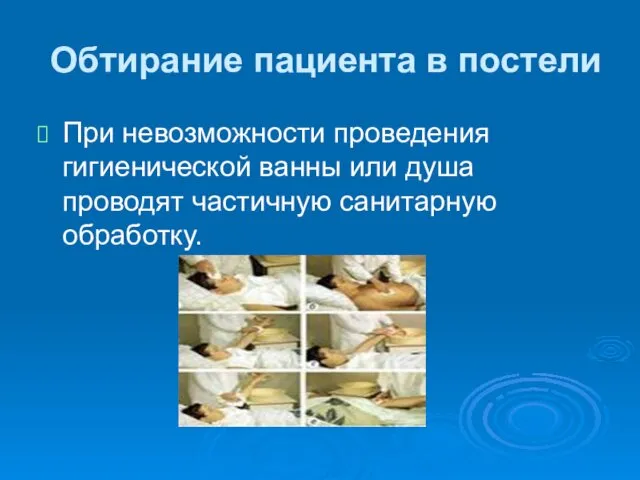 Обтирание пациента в постели При невозможности проведения гигиенической ванны или душа проводят частичную санитарную обработку.