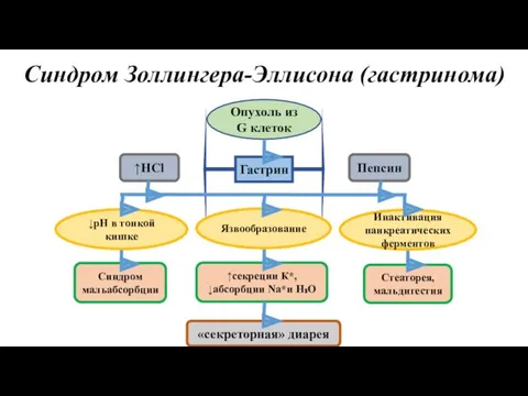 Синдром Золлингера-Эллисона (гастринома) Опухоль из G клеток Гастрин ↑HCl Пепсин