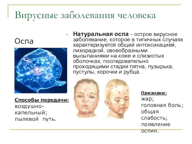 Вирусные заболевания человека Натуральная оспа - острое вирусное заболевание, которое