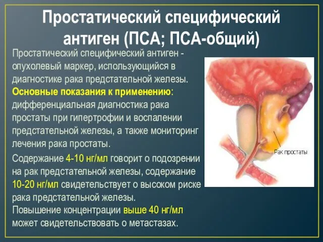 Простатический специфический антиген (ПСА; ПСА-общий) Простатический специфический антиген - опухолевый