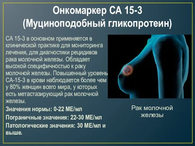 Онкомаркер СА 15-3 (Муциноподобный гликопротеин) СА 15-3 в основном применяется