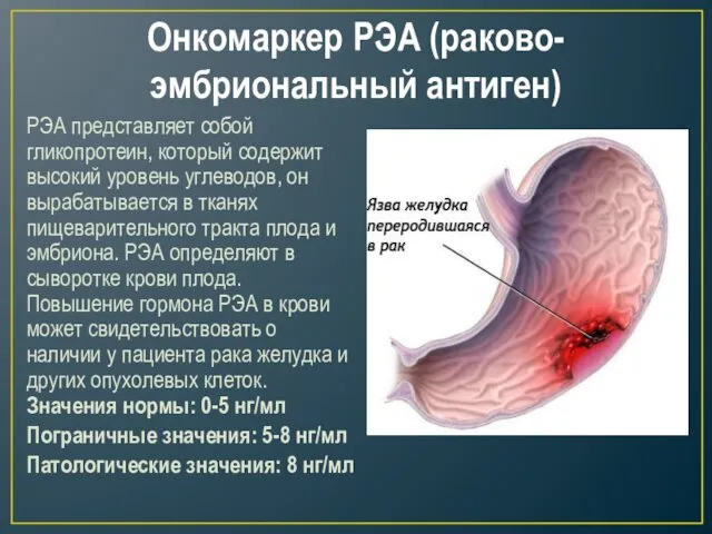 Онкомаркер РЭА (раково-эмбриональный антиген) РЭА представляет собой гликопротеин, который содержит