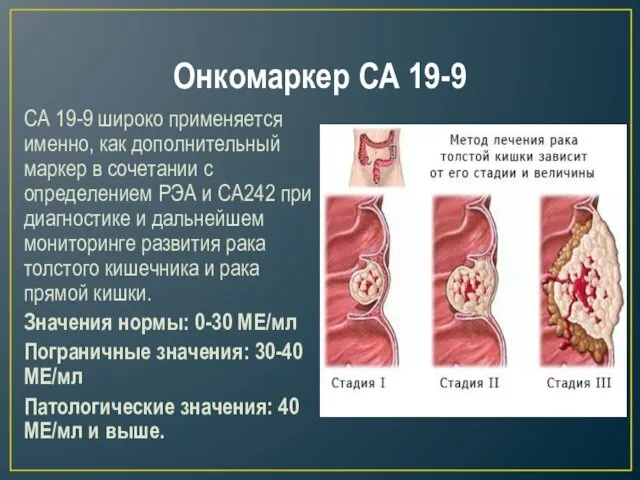 Онкомаркер СА 19-9 СА 19-9 широко применяется именно, как дополнительный