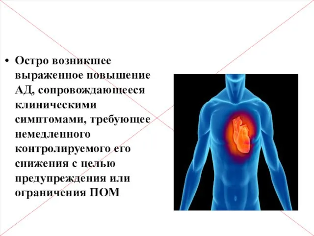 Гипертонический криз (ГК) Остро возникшее выраженное повышение АД, сопровождающееся клиническими