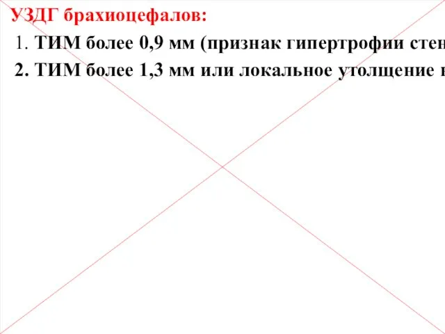 Сосуды УЗДГ брахиоцефалов: 1. ТИМ более 0,9 мм (признак гипертрофии