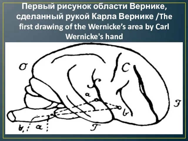 Первый рисунок области Вернике, сделанный рукой Карла Вернике /The first