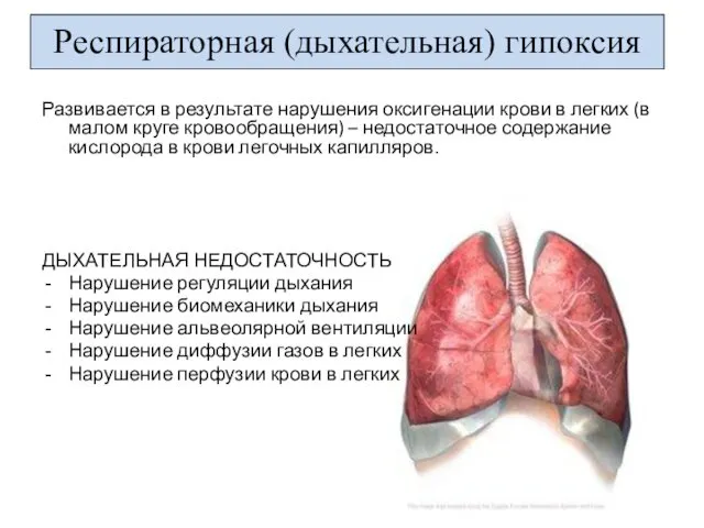 Развивается в результате нарушения оксигенации крови в легких (в малом