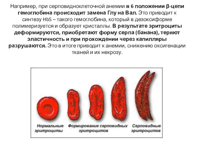 Например, при серповидноклеточной анемии в 6 положении β-цепи гемоглобина происходит замена Глу на