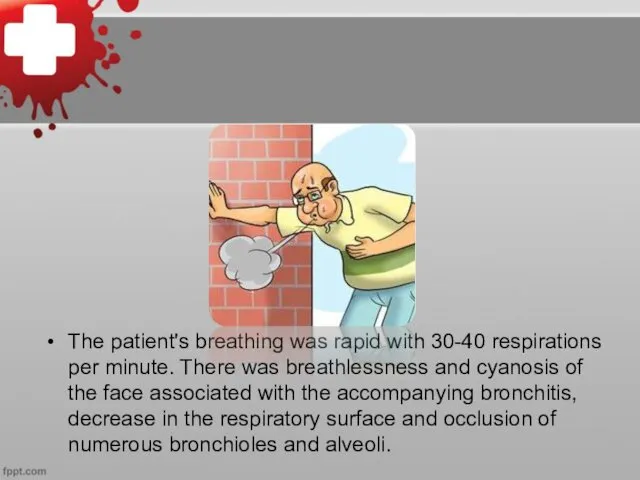 The patient's breathing was rapid with 30-40 respirations per minute.