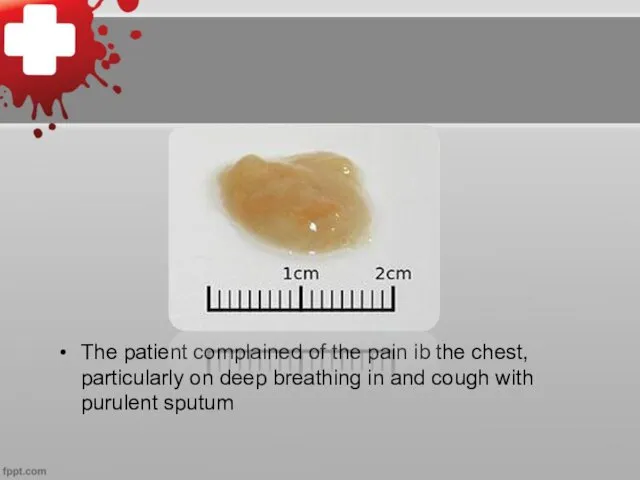 The patient complained of the pain ib the chest, particularly