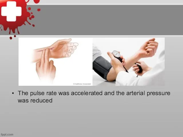 The pulse rate was accelerated and the arterial pressure was reduced