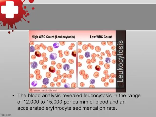 The blood analysis revealed leucocytosis in the range of 12,000