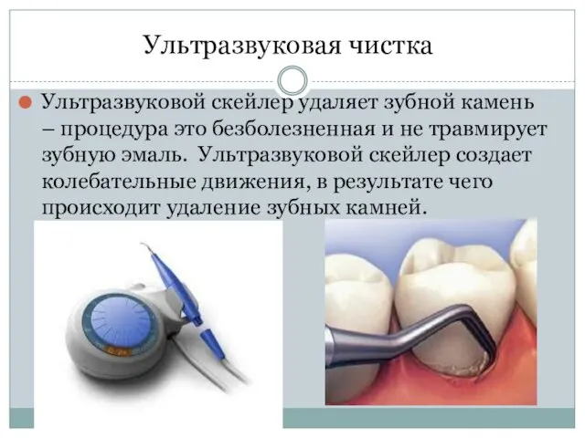 Ультразвуковая чистка Ультразвуковой скейлер удаляет зубной камень – процедура это
